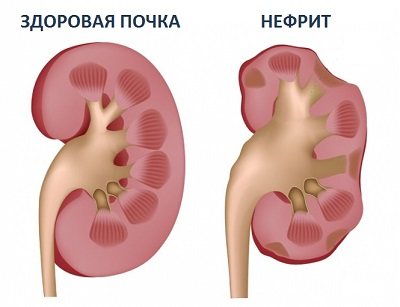 Нефрит